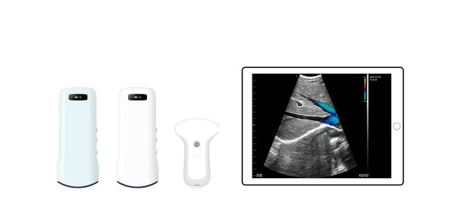 Métodos de examen de ultrasonido para el área abdominal