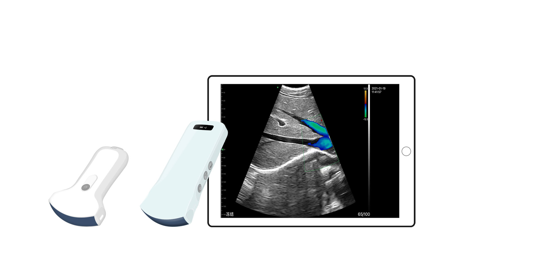 ¿Cuáles son las aplicaciones clínicas de las sondas de ultrasonido abdominal?