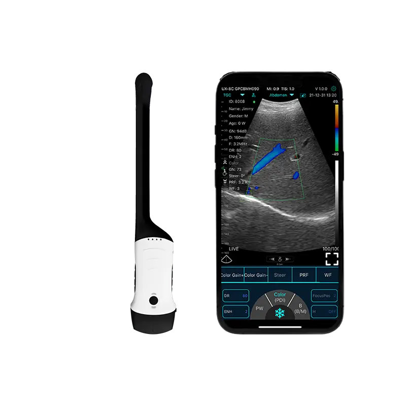 El escáner de ultrasonido portátil abre una nueva era en el examen médico